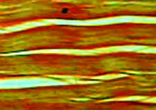 Fibrous connective tissue: strong fibres lying in rows, the tissue that binds organs and gives them shape