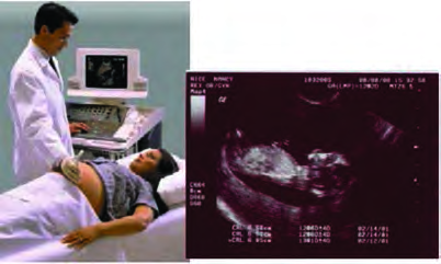 Ultrasonography being done with the transducer on the abdomen, and the two dimensional sonogram it produces