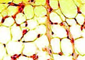 Adipose connective tissue: large cells filled with fat, the body's own cushion