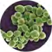 The round single cells of yeast as a microscope shows them; these are what carry out fermentation