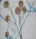 Mucor as the microscope shows it: thread like stalks each carrying a round case at its tip