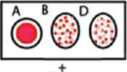 B+ve: the B and D drops are grainy and the A drop is smooth.