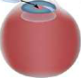 The clouded lens has been broken up and removed through a fine hole at the edge of the cornea.