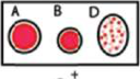 O+ve: A and B stay smooth, and only the D drop is grainy.
