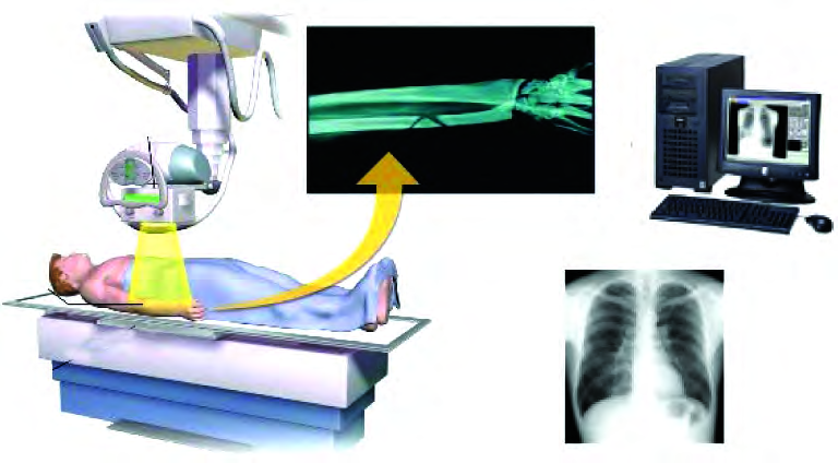 Rays from the X-ray generator pass through the body onto the detector; the radiograph they form can be viewed on a monitor and printed out.