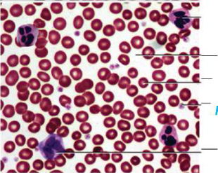 Composition of blood under a microscope: countless round red blood cells, a few larger white blood cells with dark purple nuclei, tiny dot-like platelets, and pale plasma between them all.