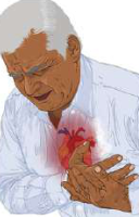 A man gripping his chest in pain: a heart problem can show itself suddenly like this.